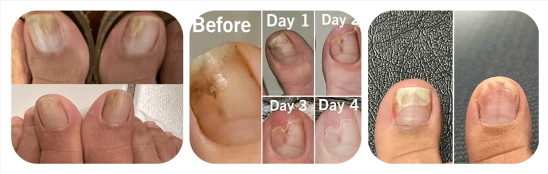 Fungabeam Customers reviews